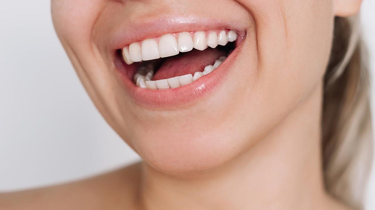 Smiling woman's broken, teeth -centered.
